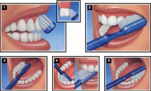 spazzolare-i-denti-300x181